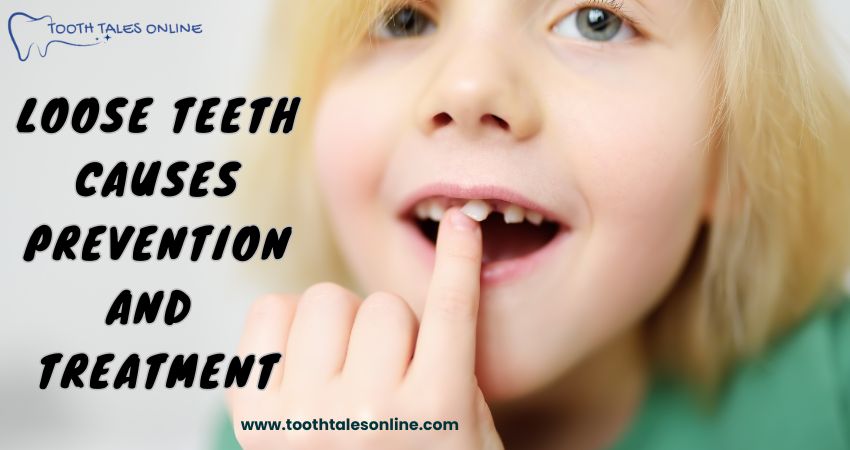 Loose Teeth Causes, Prevention, and Treatment